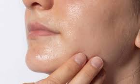 پوست چرب چیست و چرا ایجاد می‌شود؟