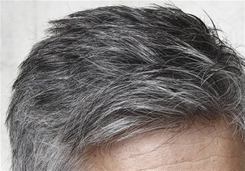سفیدی مو؛ دلایل، روش‌های طبیعی و دارویی